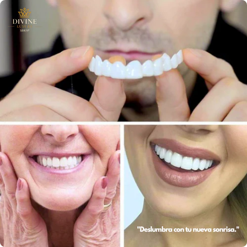 Snapon Smile - Carillas Dentales