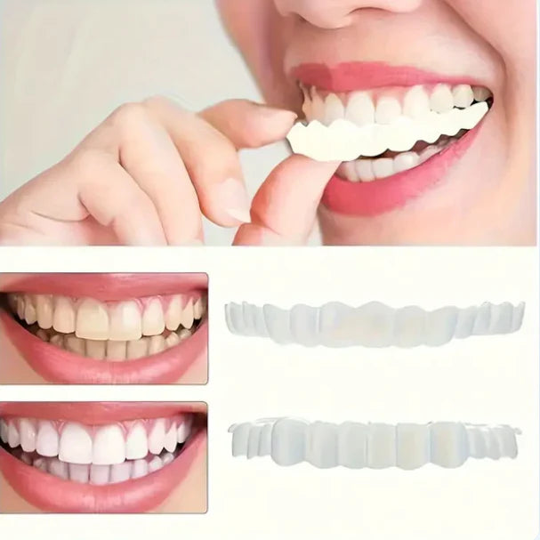 Snapon Smile - Carillas Dentales
